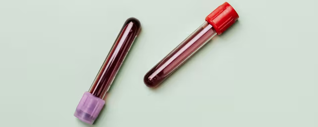 the doctors blood test referrals screening.jpg