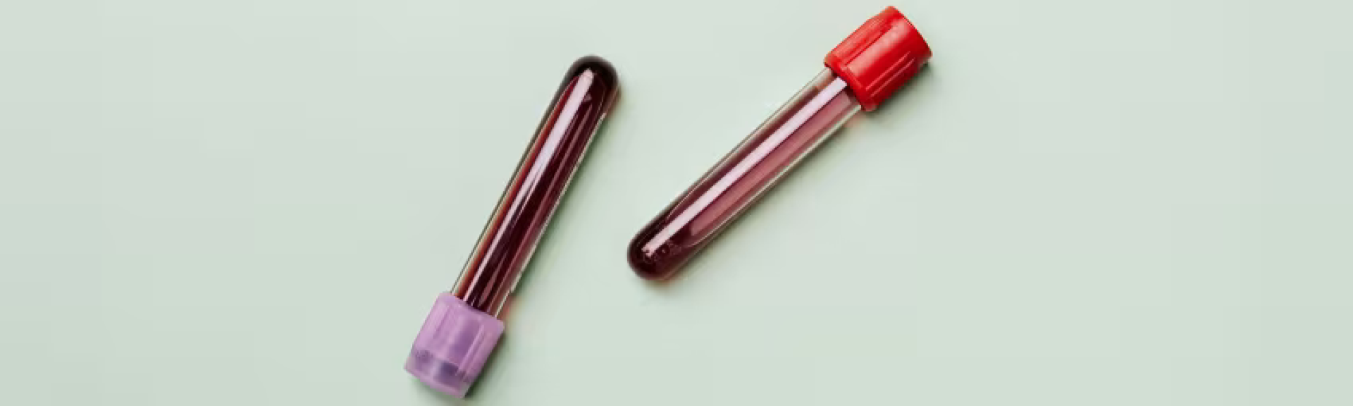 the doctors blood test referrals screening.jpg