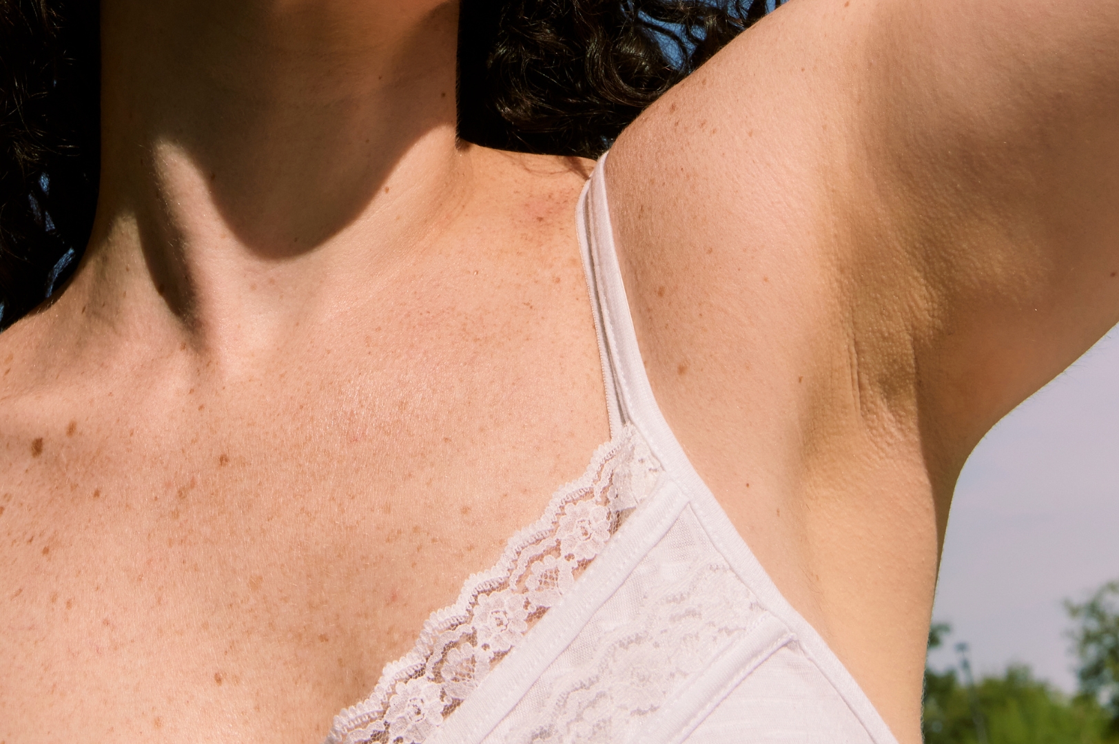 Image of light skinned person with freckles