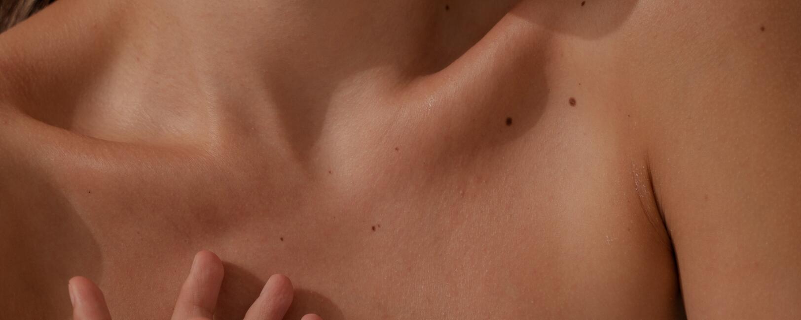 Skin check spots