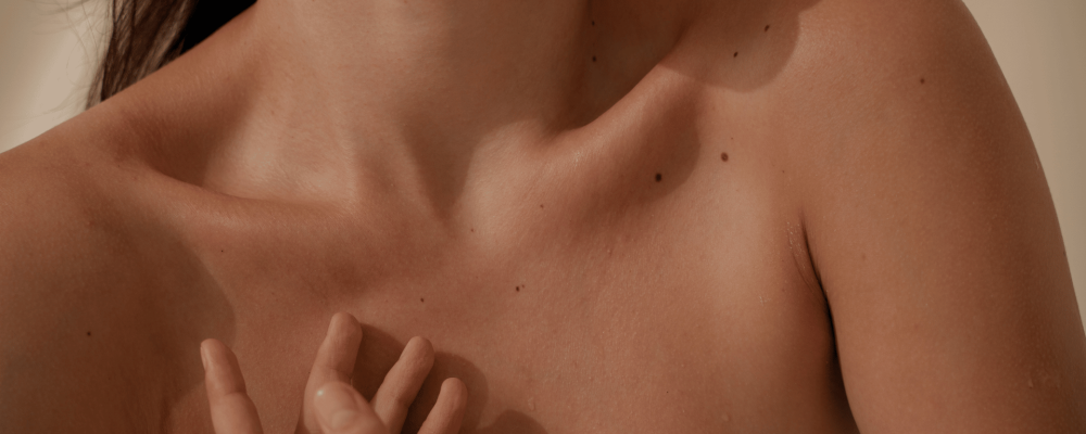 Woman showing skin with moles