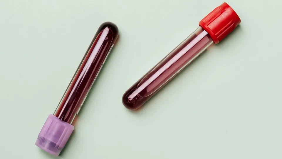 Blood Test Referrals Screening