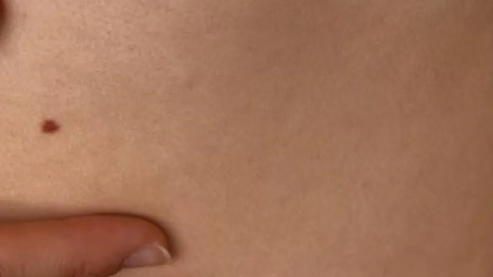 Get your skin checked at The Doctors 