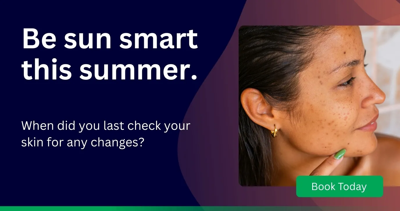Be sun smart this summer - get your skin checked